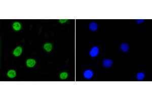 Image no. 3 for anti-Nuclear Factor (erythroid-Derived 2)-Like 2 (NFE2L2) (pSer40) antibody (ABIN5557501)