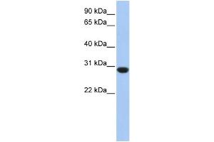 Image no. 1 for anti-Ankyrin Repeat and SOCS Box-Containing 12 (ASB12) (C-Term) antibody (ABIN2784972)