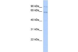 Image no. 1 for anti-Zinc Finger Protein 319 (ZNF319) (N-Term) antibody (ABIN2784270)