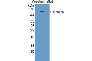 Image no. 2 for anti-NUAK Family, SNF1-Like Kinase, 1 (NUAK1) (AA 404-651) antibody (ABIN5014025)