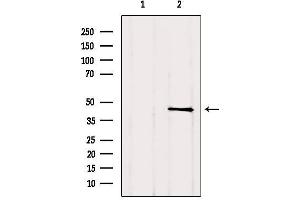 Image no. 1 for anti-TGFB-Induced Factor Homeobox 1 (TGIF1) (C-Term) antibody (ABIN6265552)