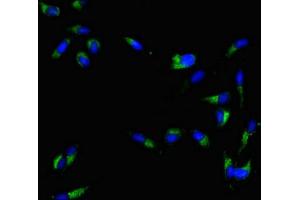 MAL antibody  (AA 1-84)