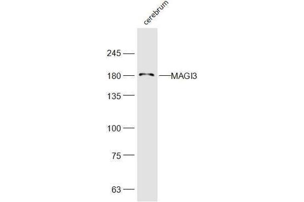 anti-Membrane Associated Guanylate Kinase, WW and PDZ Domain Containing 3 (MAGI3) (AA 181-280) antibody