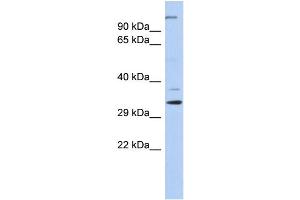 Image no. 1 for anti-Actin Related Protein 2/3 Complex, Subunit 2, 34kDa (ARPC2) (N-Term) antibody (ABIN2787750)
