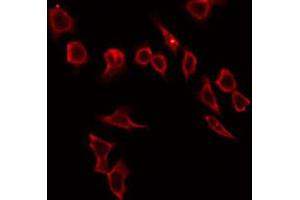 Image no. 2 for anti-Hyaluronan Binding Protein 2 (HABP2) antibody (ABIN6262142)