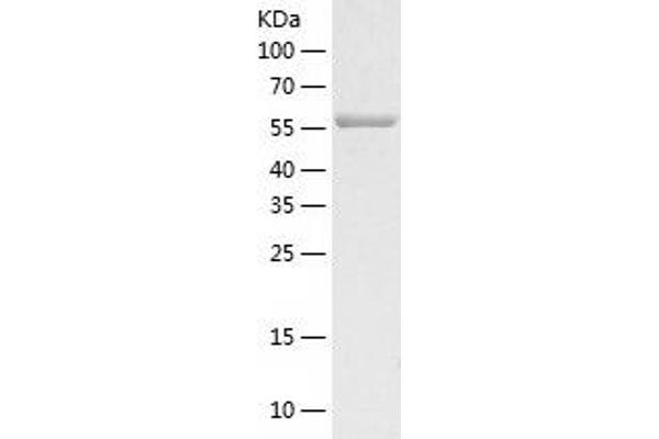 OB Cadherin Protein (AA 54-617) (His tag)