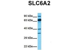 Image no. 2 for anti-Solute Carrier Family 6 (Neurotransmitter Transporter, Noradrenalin), Member 2 (SLC6A2) (Middle Region) antibody (ABIN2777051)
