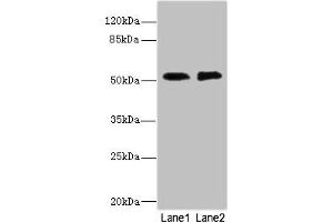Western blot All lanes: TMOD1 antibody at 2.