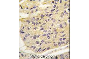 Image no. 2 for anti-Frequently Rearranged in Advanced T-Cell Lymphomas (FRAT1) (AA 99-128) antibody (ABIN5534285)