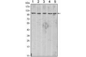 Image no. 1 for anti-Cadherin 2 (CDH2) antibody (ABIN1105629)