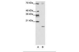 Image no. 2 for anti-Signal Recognition Particle 19kDa (SRP19) (C-Term) antibody (ABIN202029)