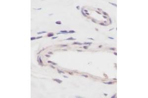Image no. 5 for anti-Vascular Endothelial Growth Factor A (VEGFA) antibody (ABIN465469)