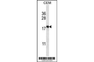 Image no. 1 for anti-Eukaryotic Translation Initiation Factor 5A2 (EIF5A2) (AA 93-122), (C-Term) antibody (ABIN657973)