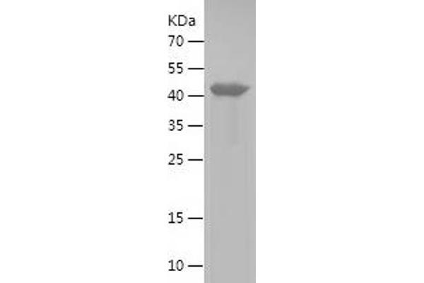 NDRG3 Protein (AA 14-255) (IF2DI tag)