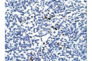 Image no. 1 for anti-T-Cell Acute Lymphocytic Leukemia 1 (TAL1) (AA 236-285) antibody (ABIN6735910)