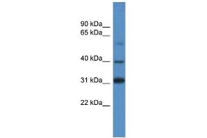 Image no. 1 for anti-SRY (Sex Determining Region Y)-Box 1 (SOX1) (C-Term) antibody (ABIN2775739)