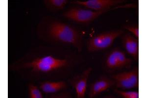 Image no. 3 for anti-Nuclear Factor of kappa Light Polypeptide Gene Enhancer in B-Cells 2 (NFKB2) (pSer870) antibody (ABIN3020406)