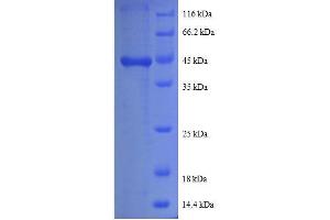 Image no. 1 for Prefoldin Subunit 5 (PFDN5) (AA 2-154), (full length) protein (GST tag) (ABIN618754)