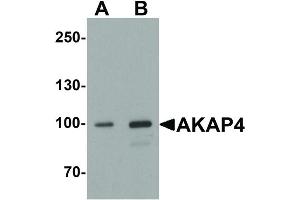 Image no. 2 for anti-A Kinase (PRKA) Anchor Protein 4 (AKAP4) (N-Term) antibody (ABIN6655246)