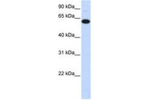 FBXO24 抗体  (C-Term)