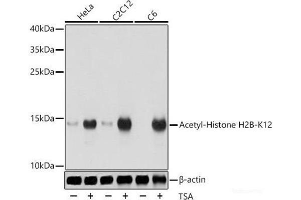 Histone H2B anticorps  (acLys12)
