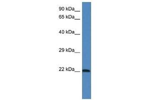 Image no. 1 for anti-Galectin-Related Protein (GRP) (Middle Region) antibody (ABIN928755)