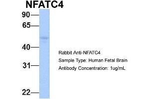 Image no. 2 for anti-Nuclear Factor of Activated T-Cells, Cytoplasmic, Calcineurin-Dependent 4 (NFATC4) (N-Term) antibody (ABIN2780606)