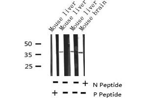 Image no. 4 for anti-Replication Protein A2, 32kDa (RPA2) (pThr21) antibody (ABIN6255629)
