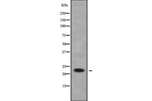 Image no. 3 for anti-RAB1B, Member RAS Oncogene Family (RAB1B) antibody (ABIN6264562)