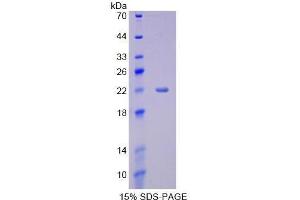 Image no. 1 for Cytochrome P450, Family 3, Subfamily A, Polypeptide 4 (CYP3A4) (AA 344-497) protein (His tag) (ABIN1099024)