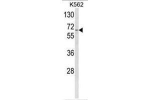 Image no. 1 for anti-Cytochrome P450, Family 4, Subfamily F, Polypeptide 3 (CYP4F3) (N-Term) antibody (ABIN453609)
