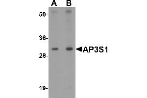 Western blot analysis of AP3S1 in mouse kidney tissue lysate with AP3S1 antibody at (A) 1 and (B) 2 µg/mL .