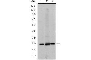 Image no. 4 for anti-Eukaryotic Translation Initiation Factor 4E (EIF4E) antibody (ABIN969094)