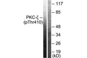 Western blot analysis of extracts from NIH-3T3 cells treated with PMA 125ng/ml 30', using PKC zeta (Phospho-Thr410) Antibody.