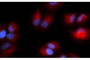 Image no. 1 for anti-Glycyl-tRNA Synthetase (GARS) (AA 43-289) antibody (PE) (ABIN5565503)