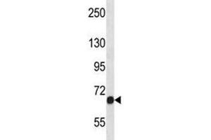 Image no. 3 for anti-Fibroblast Growth Factor Receptor 1 (FGFR1) (AA 756-784) antibody (ABIN3028659)