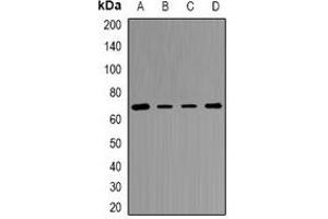 Image no. 3 for anti-Transketolase (TKT) antibody (ABIN3198354)