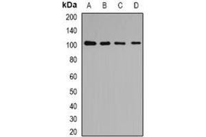 Image no. 2 for anti-Coatomer Protein Complex, Subunit beta 2 (COPB2) (full length) antibody (ABIN6005532)
