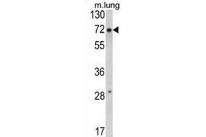 Image no. 3 for anti-Fragile X Mental Retardation 1 (FMR1) antibody (ABIN3002852)