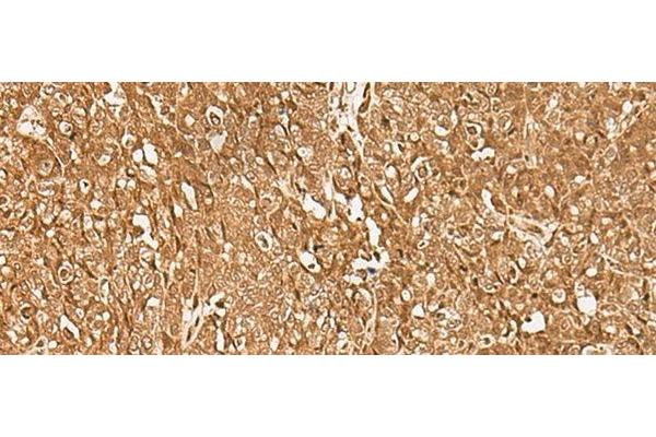GMEB2 antibody