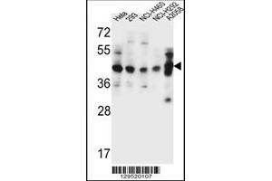 Image no. 1 for anti-General Transcription Factor IIH, Polypeptide 2C (GTF2H2C) (AA 314-343), (C-Term) antibody (ABIN655372)