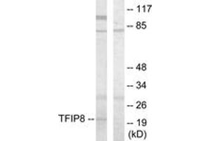 anti-Tumor Necrosis Factor, alpha-Induced Protein 8 (TNFAIP8) (AA 31-80) antibody