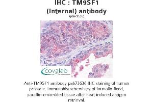 Image no. 2 for anti-Transmembrane 9 Superfamily Member 1 (TM9SF1) (Internal Region) antibody (ABIN1740137)