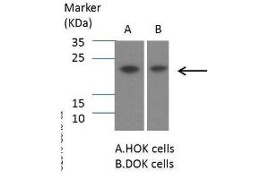 Image no. 1 for anti-Suppressor of Cytokine Signaling 1 (SOCS1) (C-Term) antibody (ABIN2854825)