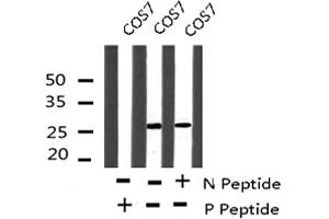 Image no. 3 for anti-Caveolin 2 (CAV2) (pSer23) antibody (ABIN6271374)