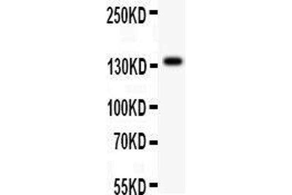 Ataxin 2 Antikörper  (C-Term)