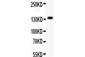 Image no. 1 for anti-Ataxin 2 (ATXN2) (AA 1283-1313), (C-Term) antibody (ABIN3043507)