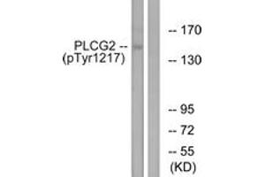Western blot analysis of extracts from Jurkat cells treated with UV 15', using PLCG2 (Phospho-Tyr1217) Antibody.