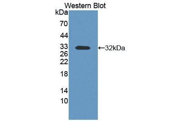 anti-Contactin Associated Protein 1 (CNTNAP1) (AA 673-918) antibody