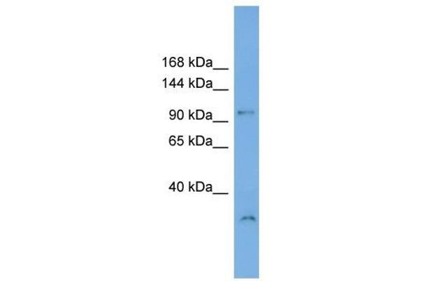 anti-DENN/MADD Domain Containing 1A (DENND1A) (N-Term) antibody